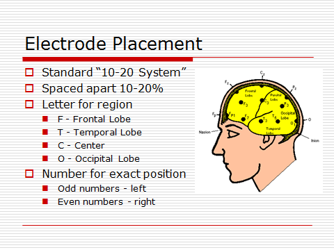 Brain Computer Interface MCA Seminar Topic PPT